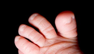 Premature baby's foot