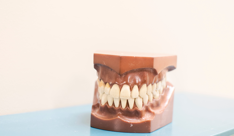 a model of a human jaw