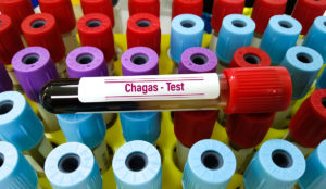 a group of test tubes with a label