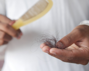 close up of man holding his lost hair