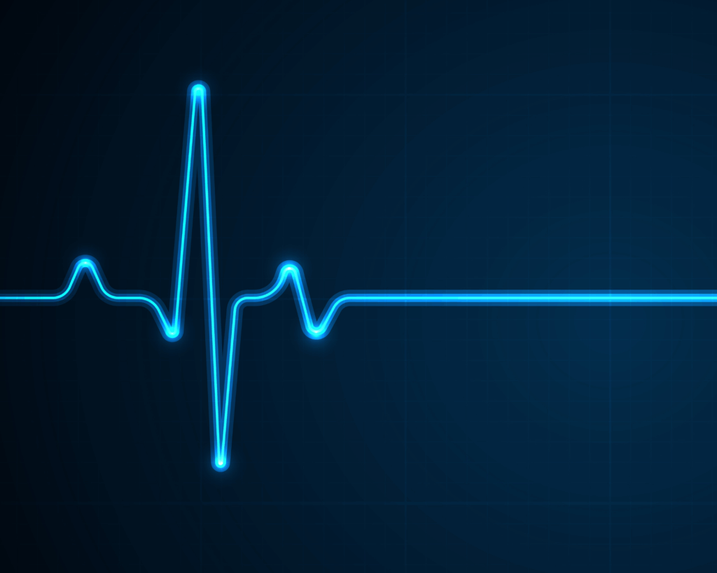 Heart beat on an EKG monitor