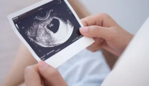 Close up of someone holding and looking down at a sonogram image