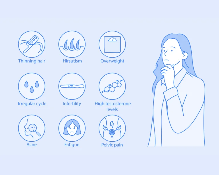 illustration about symptoms of polycystic ovary syndrome (PCOS)