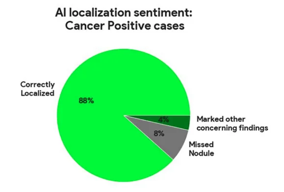 pie chart showing artificial intelligence (AI)–system nodule localization for cancer-positive cases