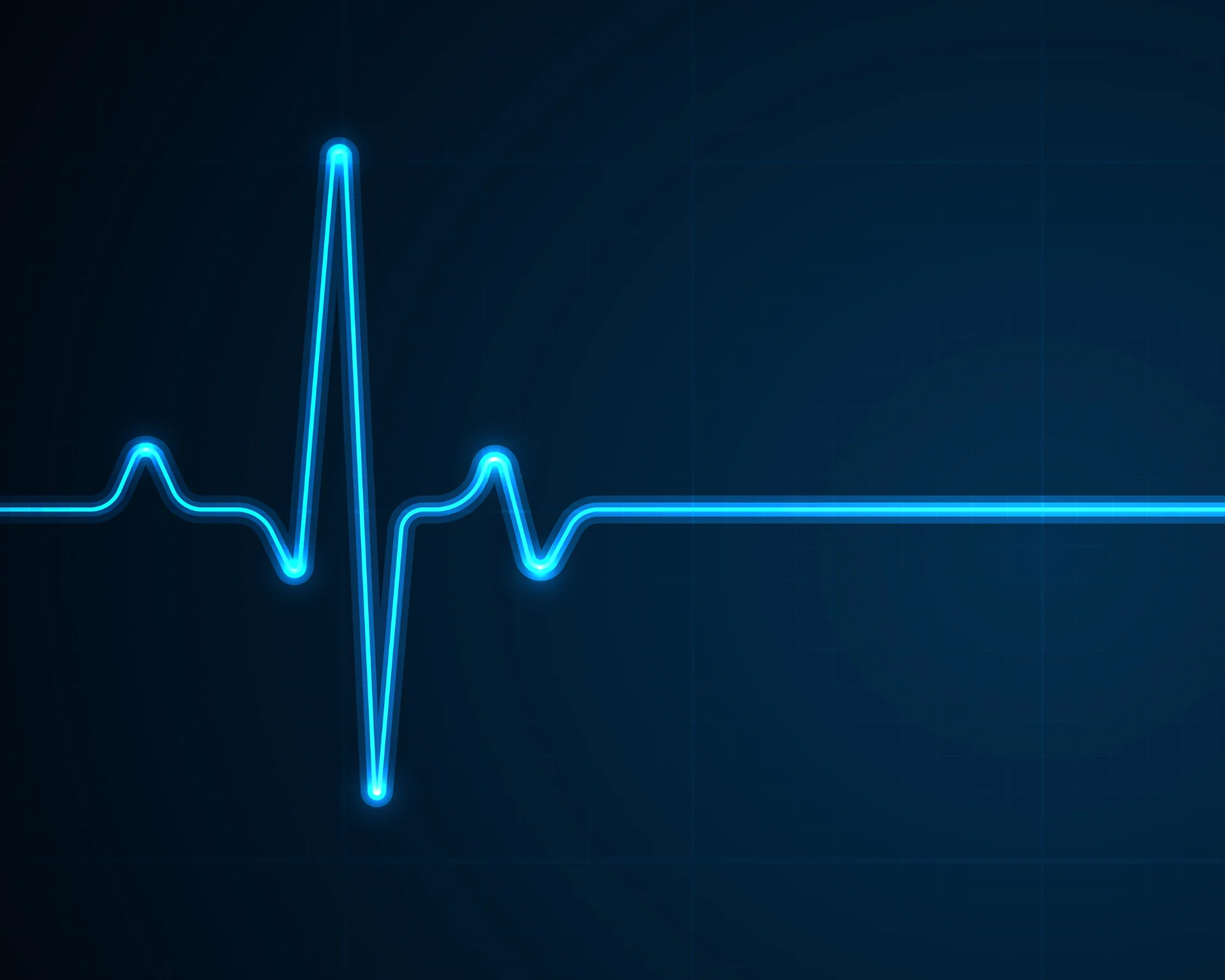Heart beat on an EKG monitor