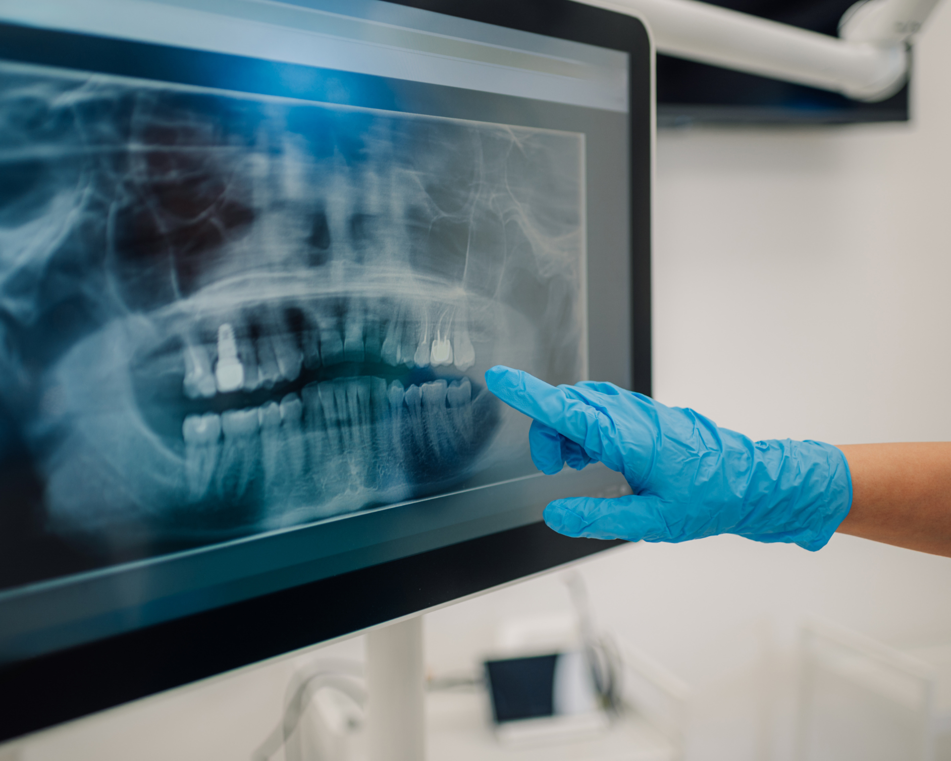Dentist pointing at teeth x-ray on computer screen in dental clinic
